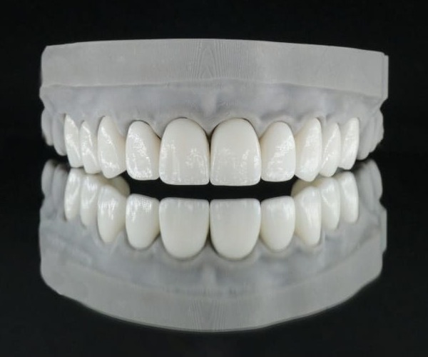Skalfasader tillverkade av Omega Dental